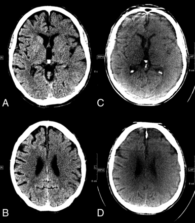 Fig 2.