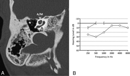Fig 3.
