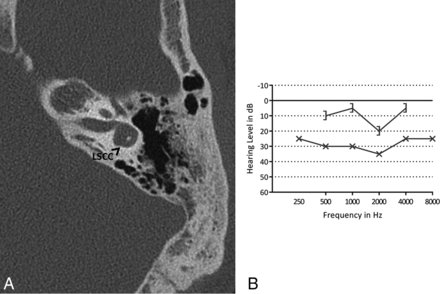Fig 4.