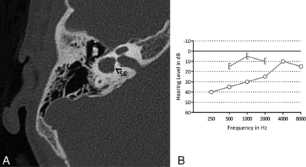 Fig 5.