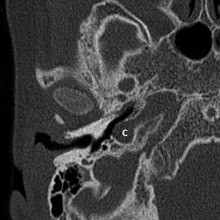 Fig 6.