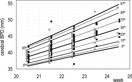 Fig 4.
