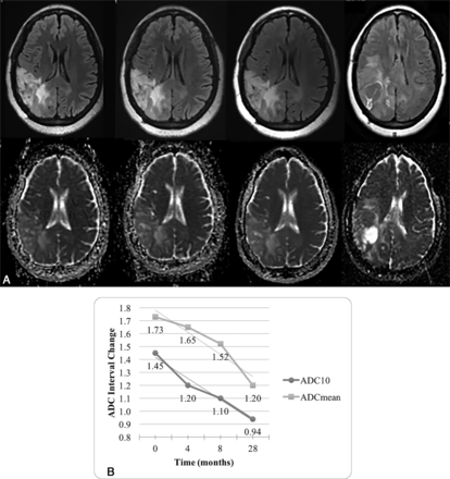Fig 4.