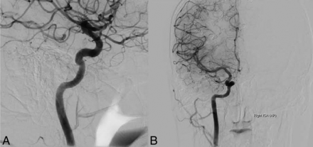Fig 3.