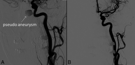 Fig 4.