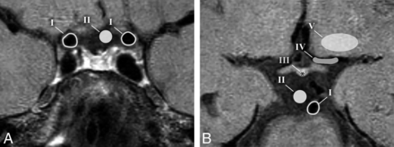 Fig 1.