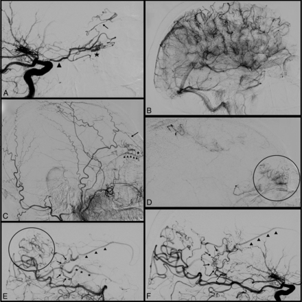 Fig 1.
