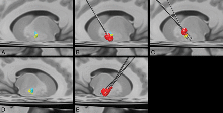 Fig 3.