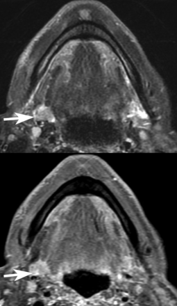 Fig 5.