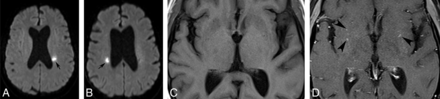 Fig 2.