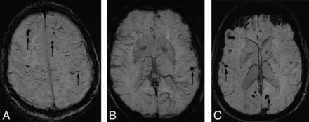 Fig 5.