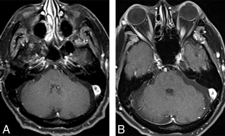 Fig 6.