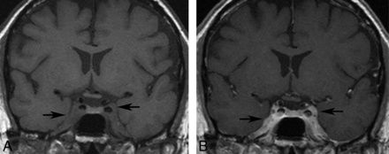 Fig 7.