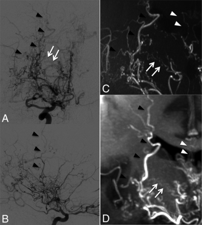 Fig 2.