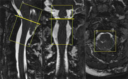 Fig 1.