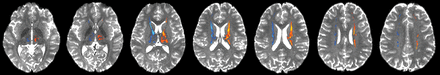 Fig 1.