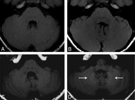Fig 2.