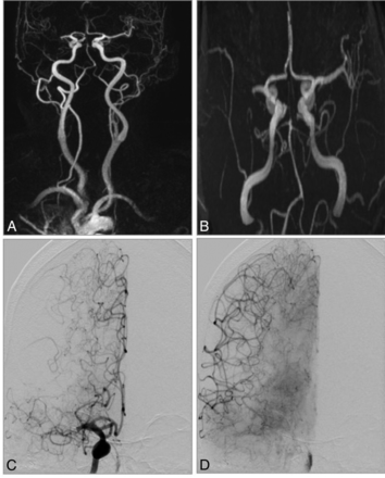Fig 4.