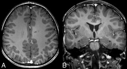 Fig 2.