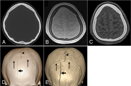 Fig 2.