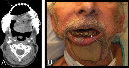 Fig 15.