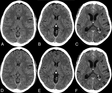 Fig 4.