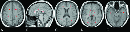 Fig 1.