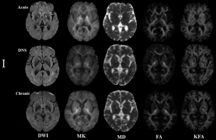 Fig 3.