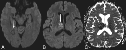 Fig 4.