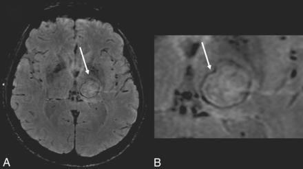 Fig 8.