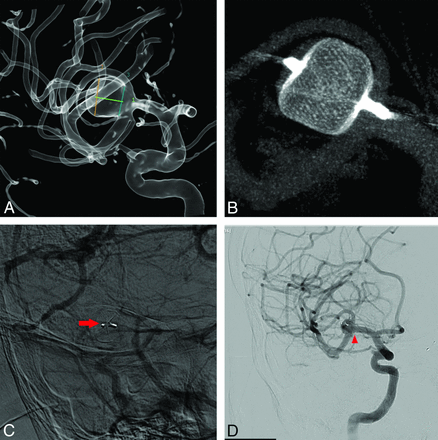 Fig 3.