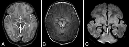 Fig 2.