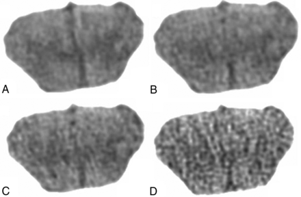 Fig 2.