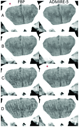Fig 5.
