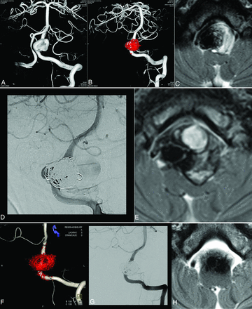 Fig 2.