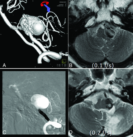 Fig 5.
