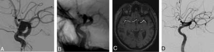 Fig 1.
