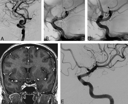 Fig 2.