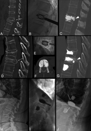 Fig 3.