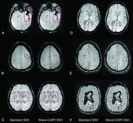 Fig 2.