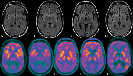 Fig 2.
