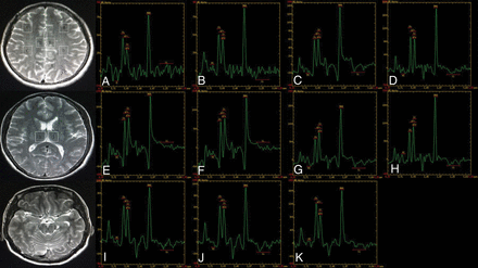 Fig 1.