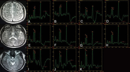 Fig 2.