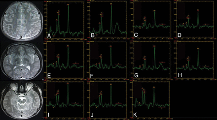 Fig 3.