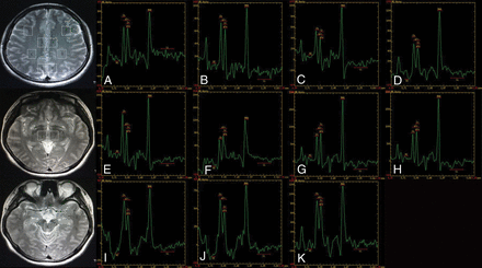 Fig 4.