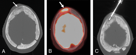 Fig 1.