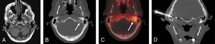 Fig 2.