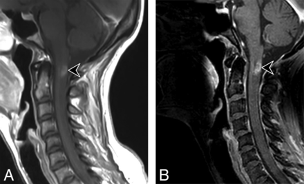 Fig 4.