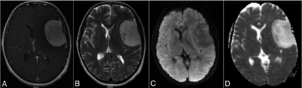 Fig 2.