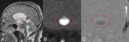 Fig 3.